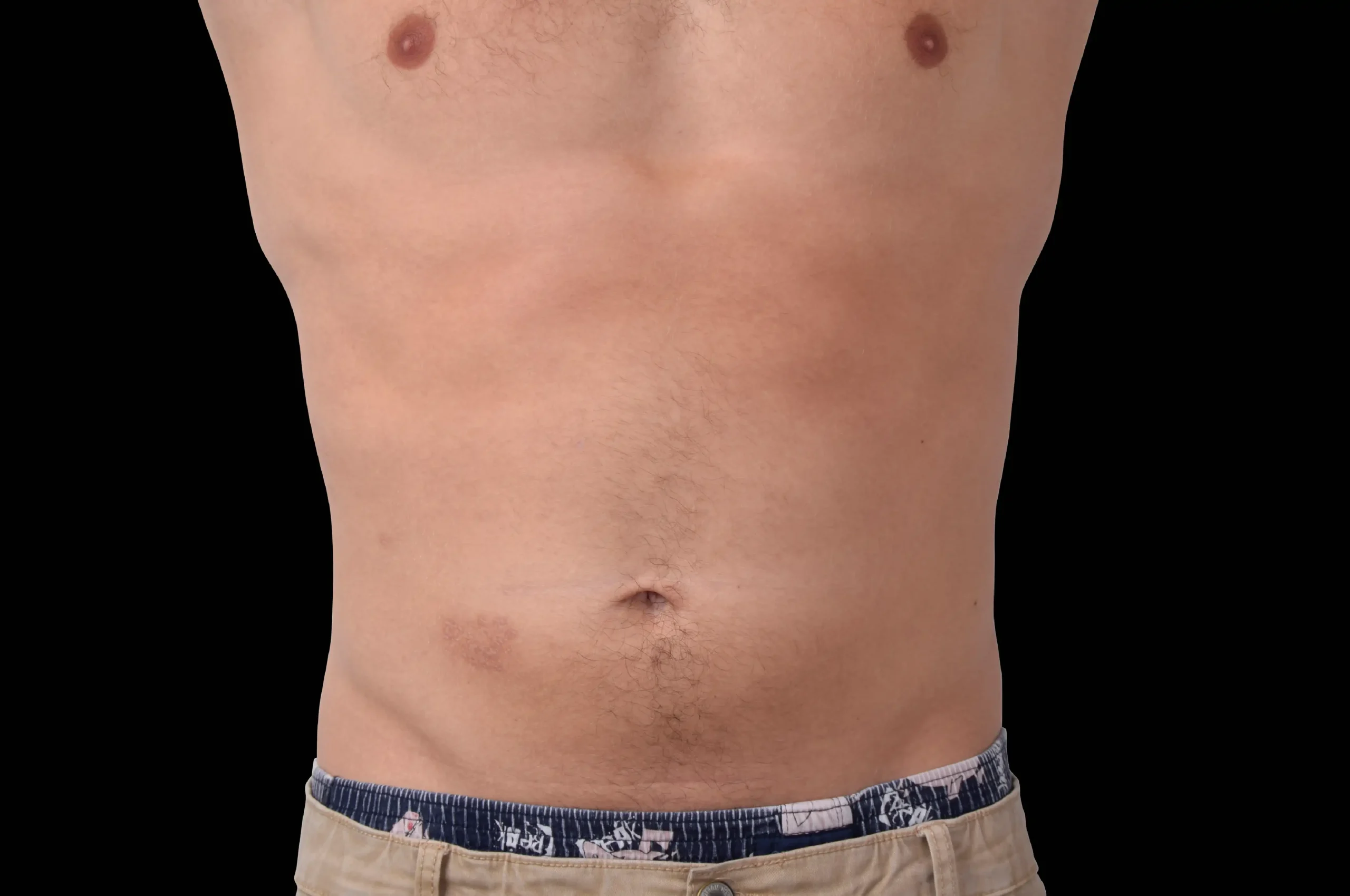 embody-abs-antes