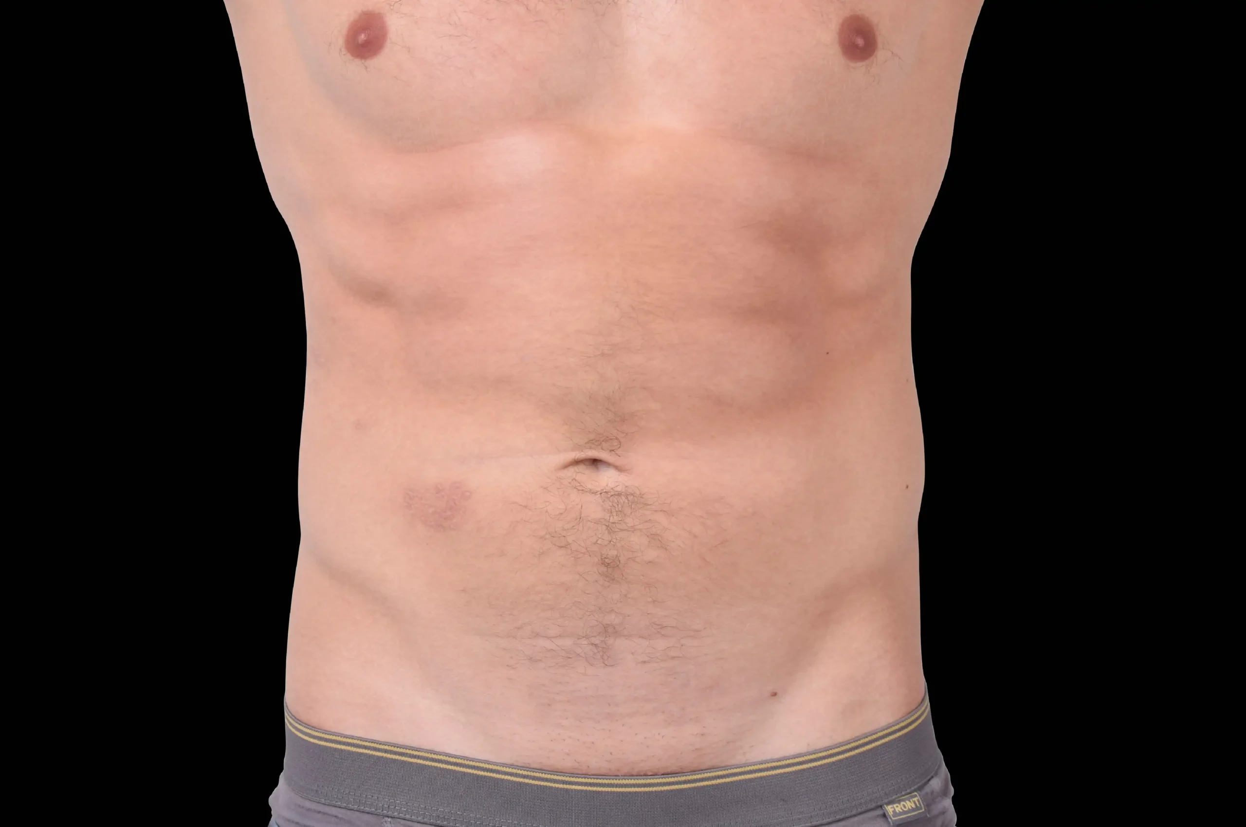 embody-abs-depois