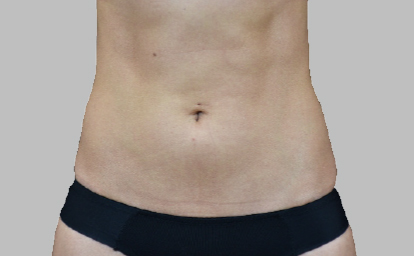 embody-abs2-depois